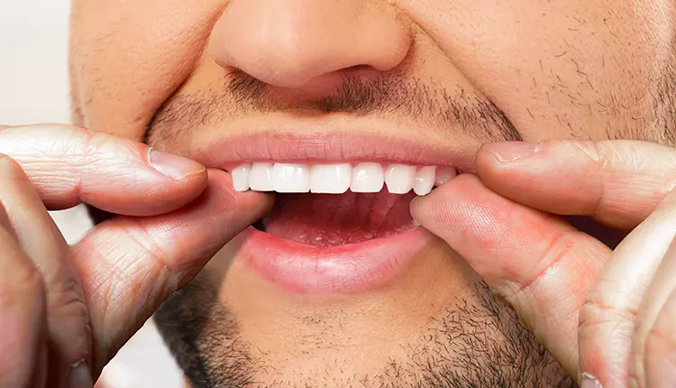 ابتسامة هوليود المتحركة